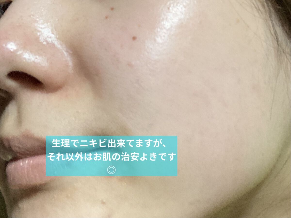 ミセラークレンジングウォーター ブライトアップ/ビフェスタ/クレンジングウォーターを使ったクチコミ（2枚目）