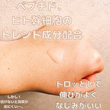 PHOEBE BEAUTY UP セラムショット　Nのクチコミ「PHOEBE BEAUTY UPのSERUM SHOT(美容液)
を定期購入して肌が変わった点.....」（2枚目）