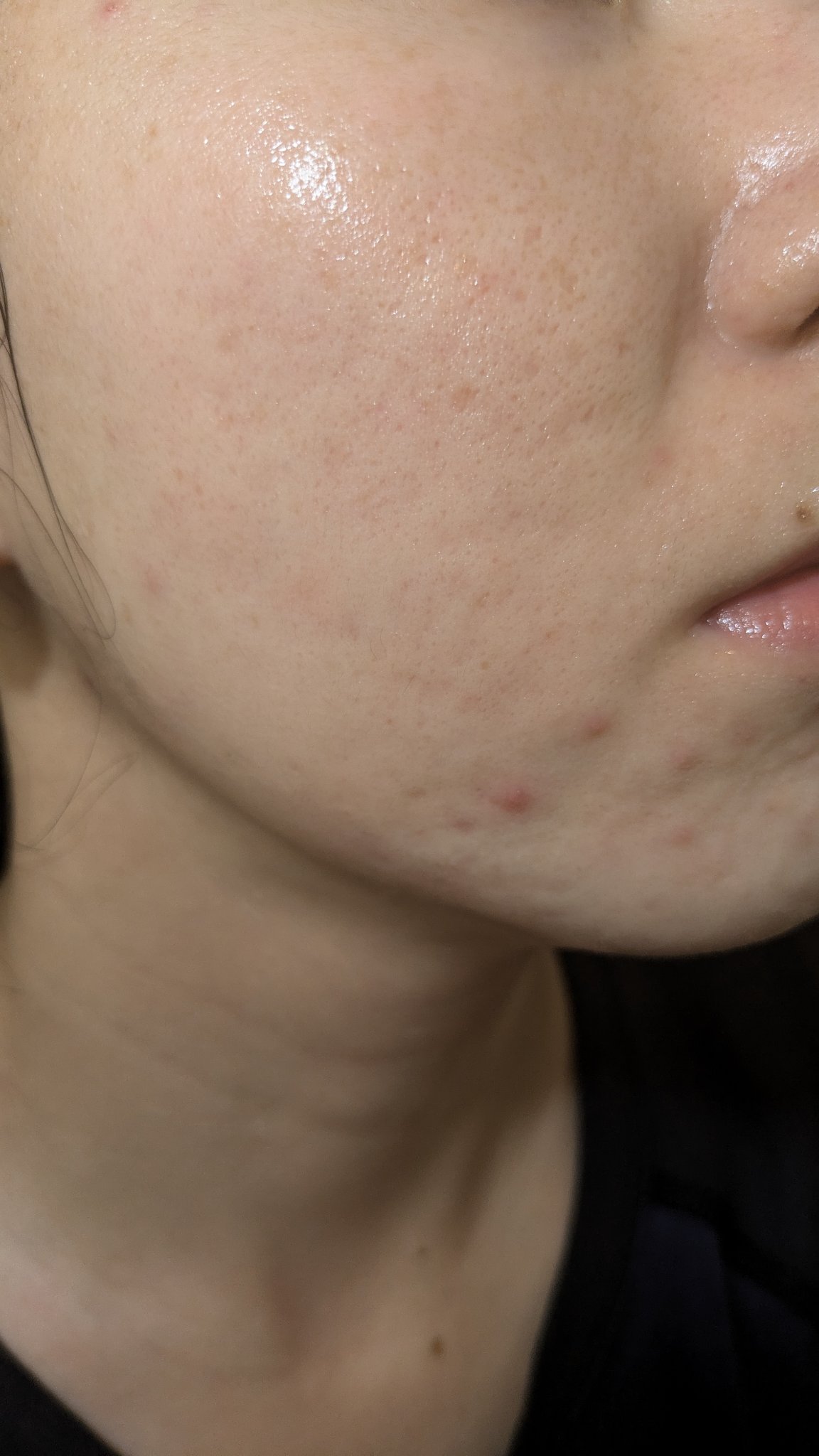 クリーム NC/なめらか本舗/フェイスクリームを使ったクチコミ（1枚目）