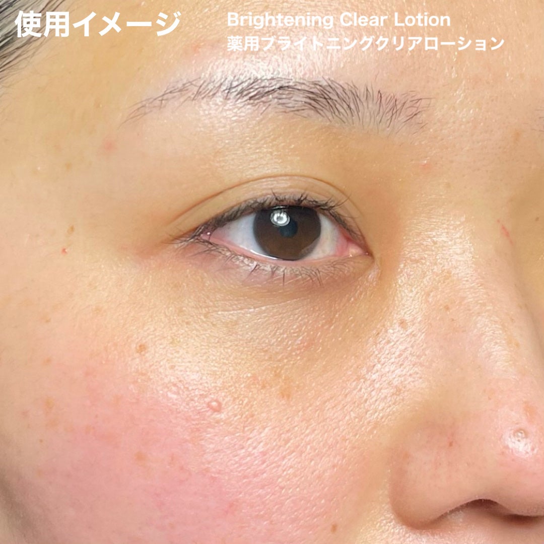 トランシーノ薬用ブライトニングクリアローション/トランシーノ/化粧水を使ったクチコミ(8枚目)