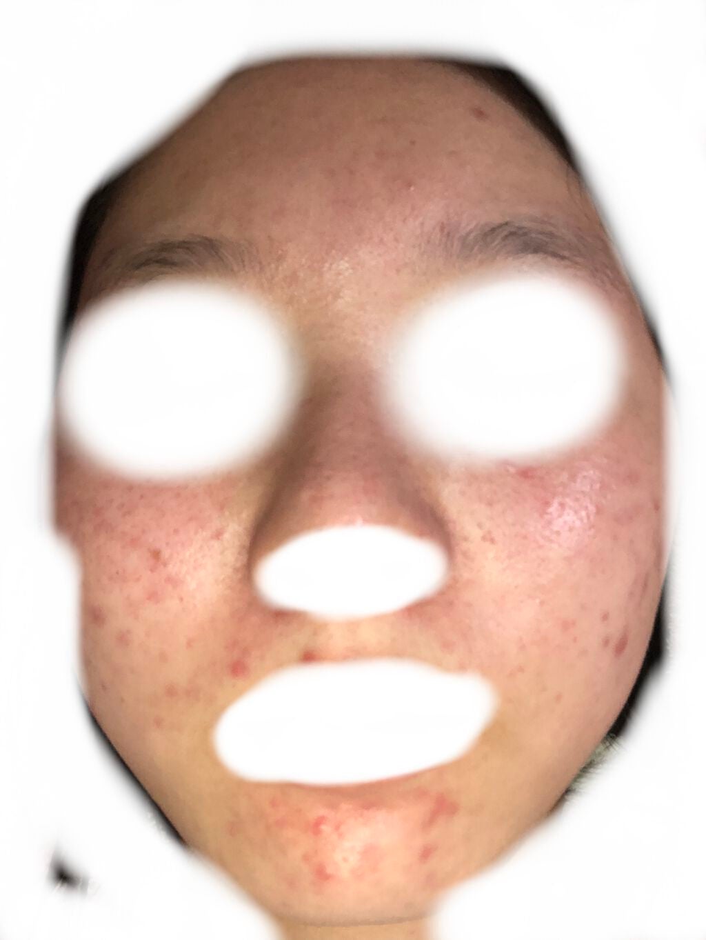 モイストボタニカル 化粧水R/unlabel/化粧水を使ったクチコミ(2枚目)