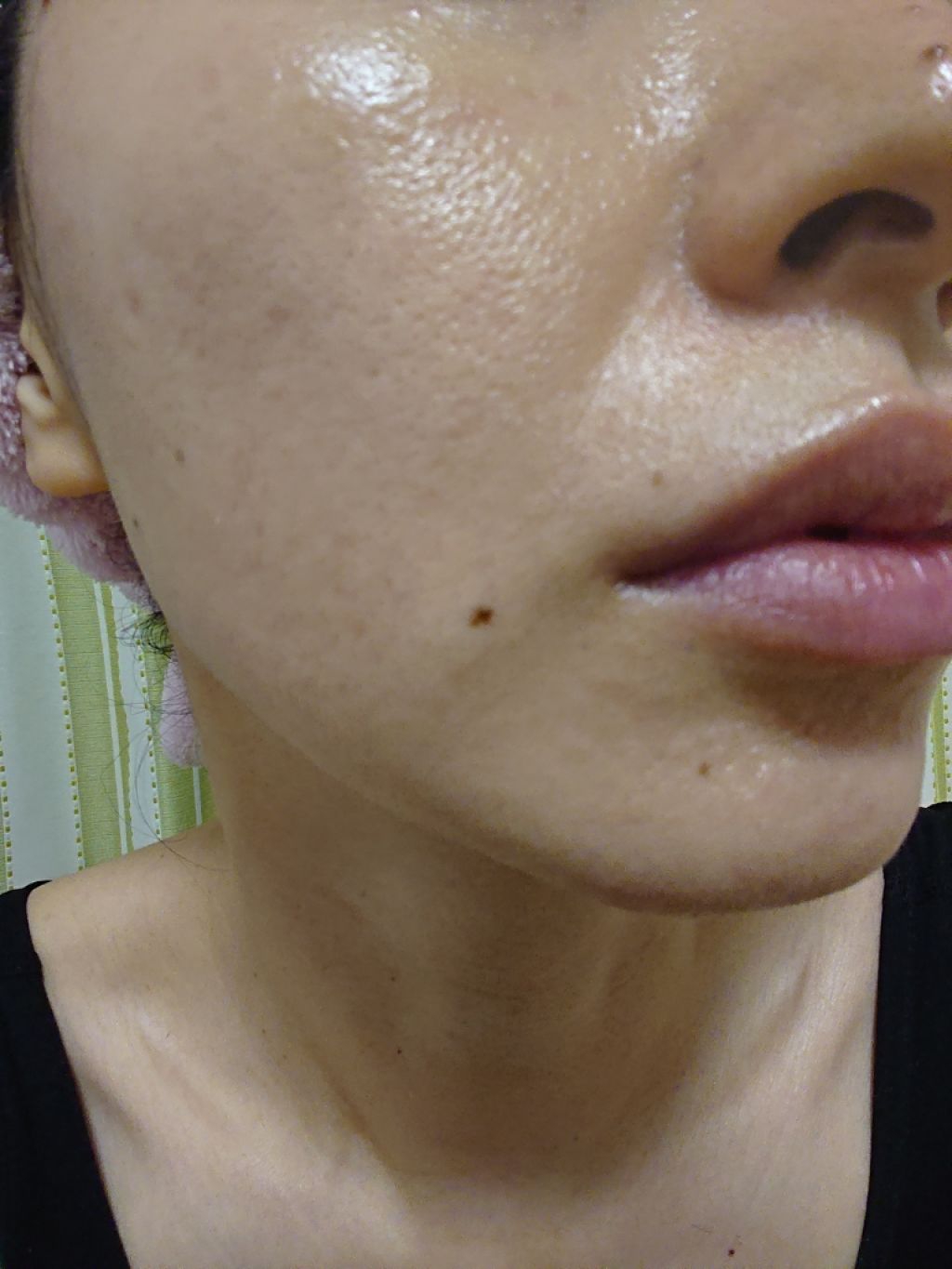 クナイプビオ オイル ローズ/クナイプ/ボディオイルを使ったクチコミ(3枚目)