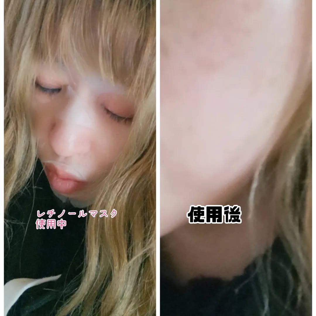 フェイスマスク 【しっかり実感30枚セット】/KISO/シートマスク・パックを使ったクチコミ(4枚目)