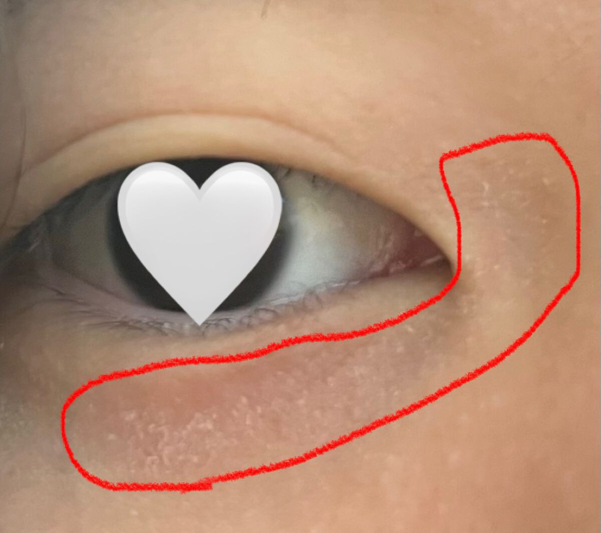 カバーパーフェクション チップコンシーラー/the SAEM/リキッドコンシーラーを使ったクチコミ(1枚目)