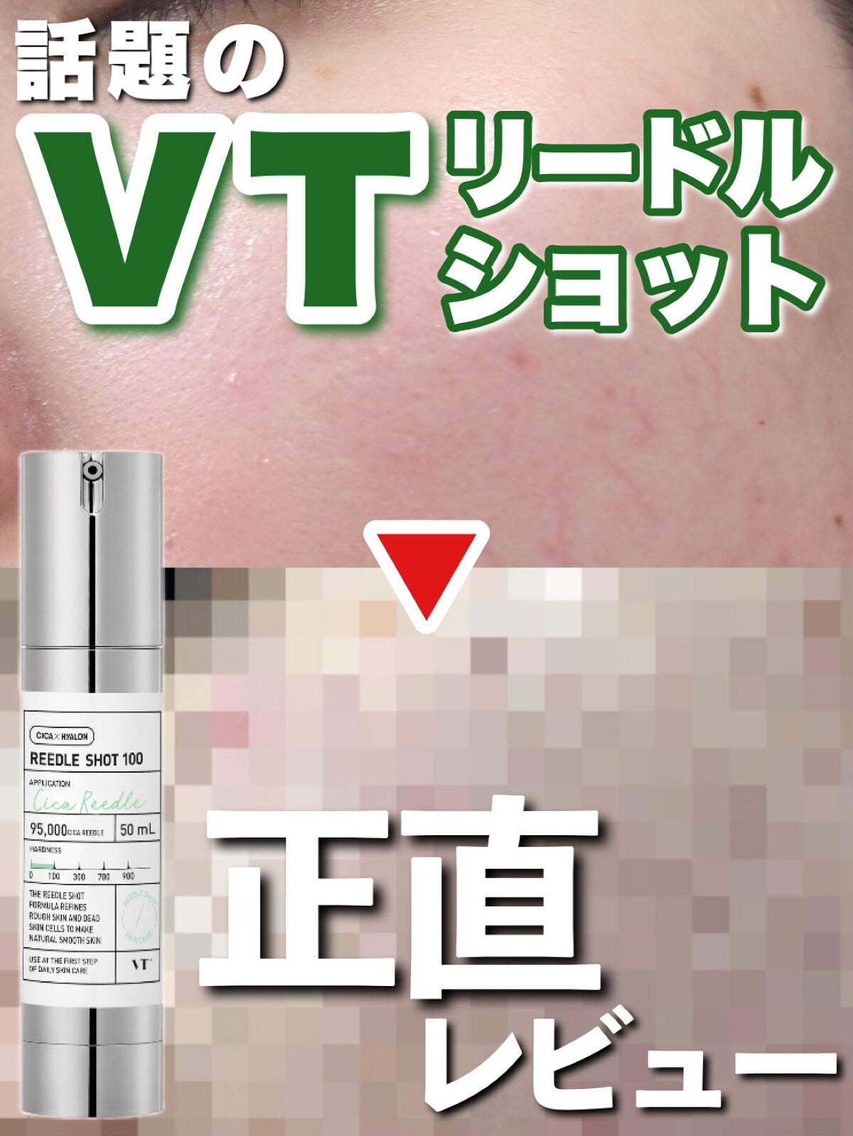 リードルショット100/VT/美容液を使ったクチコミ(1枚目)