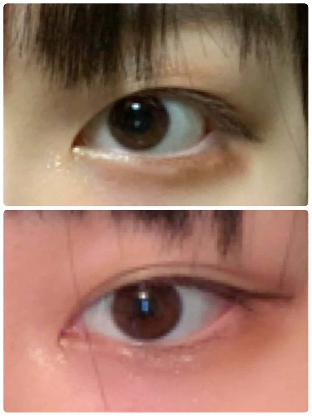 オリシキ アイリッドスキンフィルム /D-UP/二重まぶた用アイテムを使ったクチコミ(1枚目)