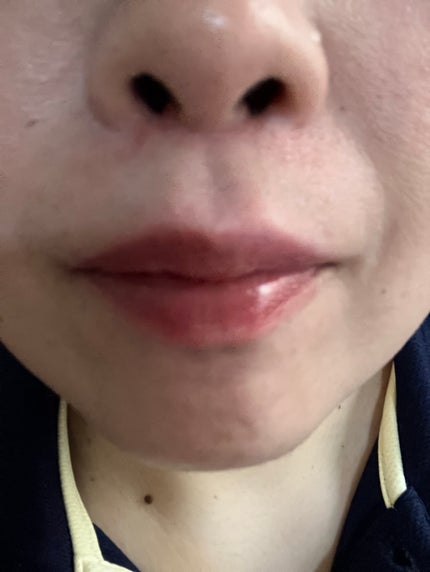 フローウェーブティント/COSNORI/リップティントを使ったクチコミ(5枚目)