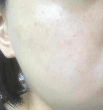 フィットミーリキッドファンデーション/MAYBELLINE NEW YORK/リキッドファンデーションを使ったクチコミ(3枚目)