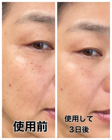 リードルショット300/VT/美容液を使ったクチコミ(5枚目)