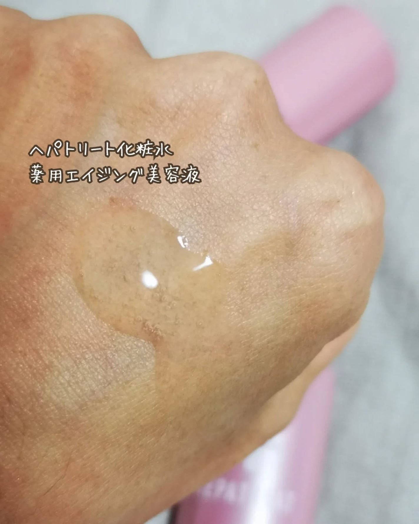 ヘパトリート 薬用保湿化粧水/ゼトックスタイル/化粧水を使ったクチコミ(6枚目)
