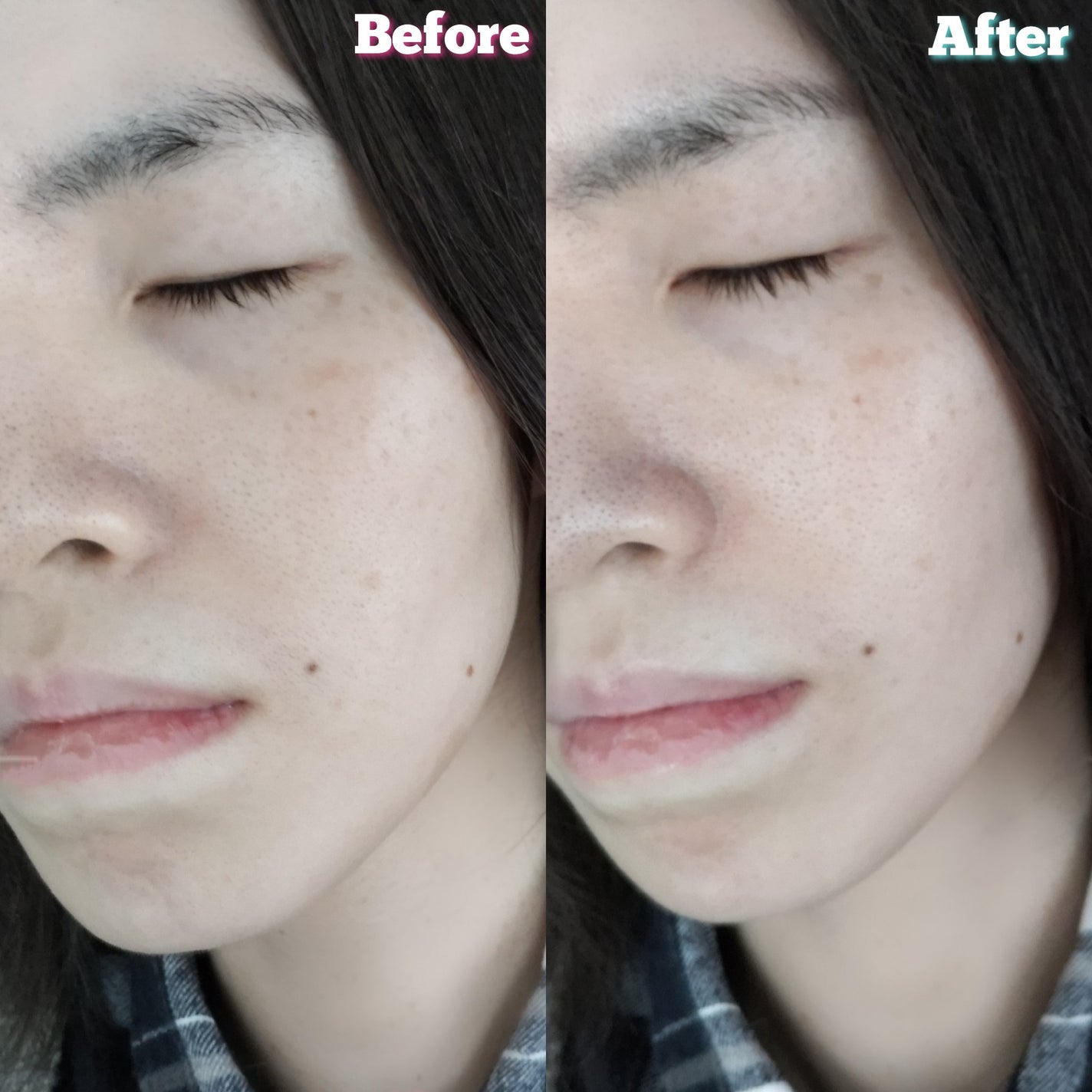 クリアエッセンス エッセンシャルトナー/ピュレア/化粧水を使ったクチコミ(5枚目)