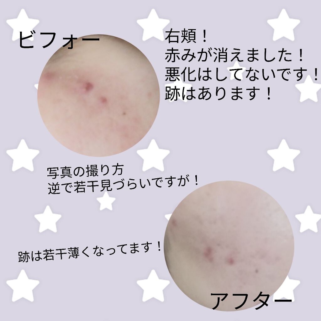 美容液 ノンアルコールタイプ/ちふれ/美容液を使ったクチコミ(2枚目)