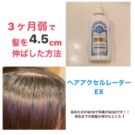 ヘアアクセルレーターEX フローラルアップルの香り/加美乃素本舗/頭皮ローションを使ったクチコミ(1枚目)