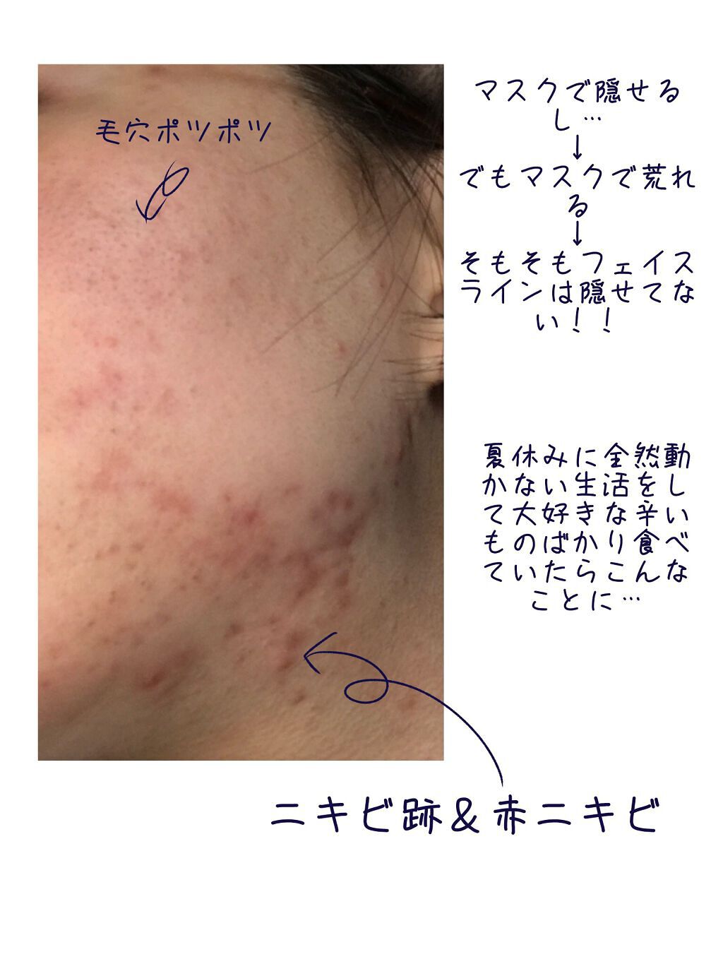 ハトムギ化粧水(ナチュリエ スキンコンディショナー R )/ナチュリエ/化粧水を使ったクチコミ（2枚目）