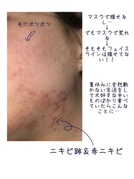 ハトムギ化粧水(ナチュリエ スキンコンディショナー R )/ナチュリエ/化粧水を使ったクチコミ(2枚目)