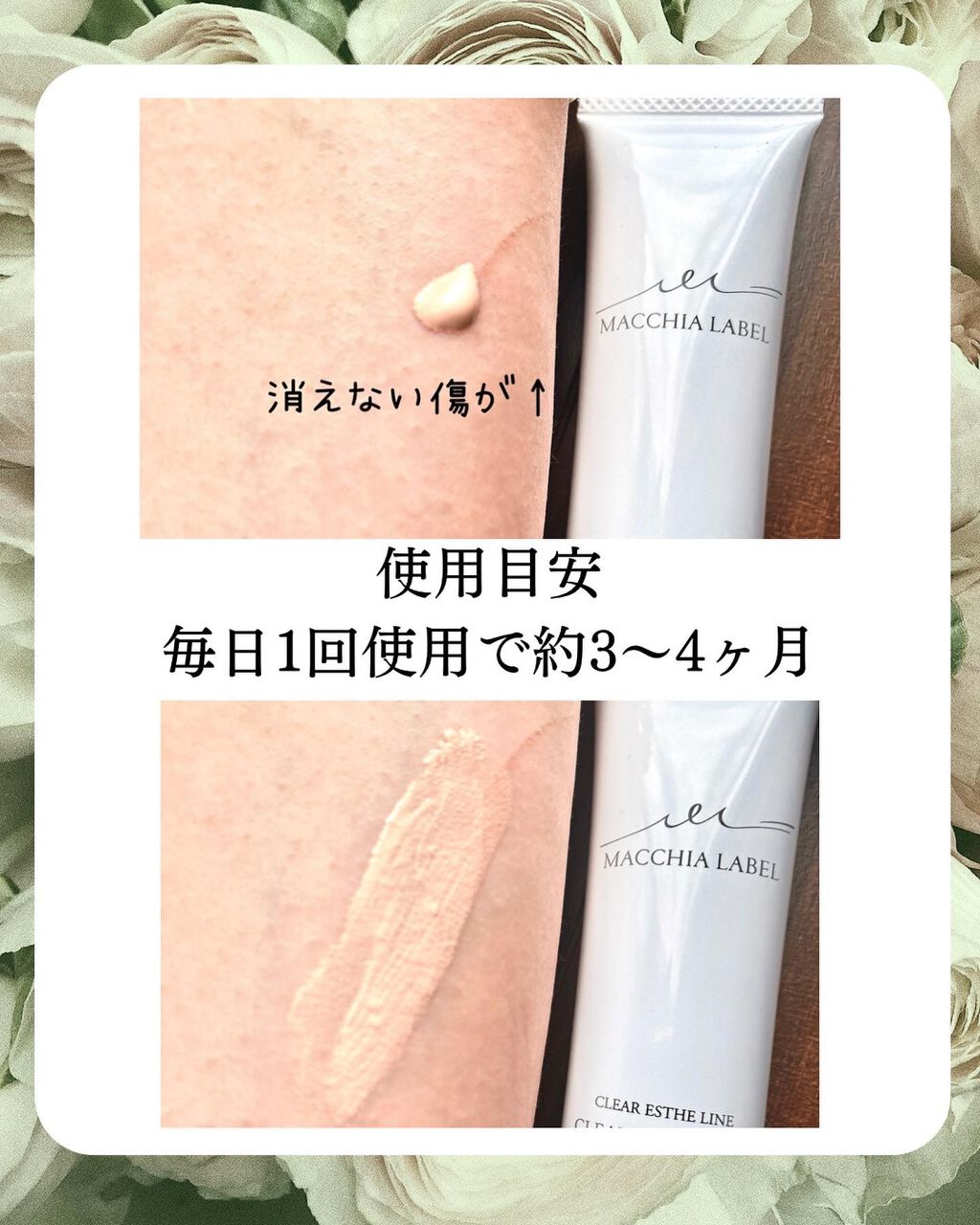 みぃ0912 on LIPS 「こんばんは🌙*゚みぃです🎀🔻𝕗𝕠𝕝𝕝𝕠𝕨𝕄𝕖🔻@miko_l..」(4枚目)