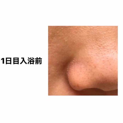 ジョンソン ベビーオイル 無香料/ジョンソンベビー/ボディオイルを使ったクチコミ(2枚目)