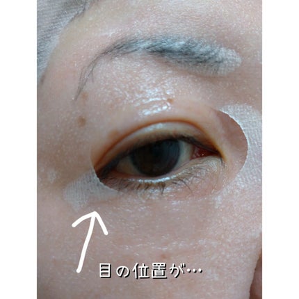 ダーマレーザースーパーVC100マスク/クオリティファースト/シートマスク・パックを使ったクチコミ(5枚目)