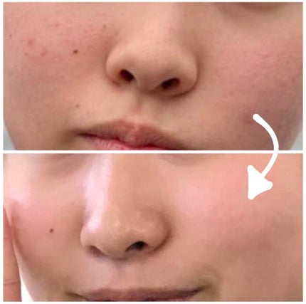 ハトムギ化粧水(ナチュリエ スキンコンディショナー R )/ナチュリエ/化粧水を使ったクチコミ(2枚目)