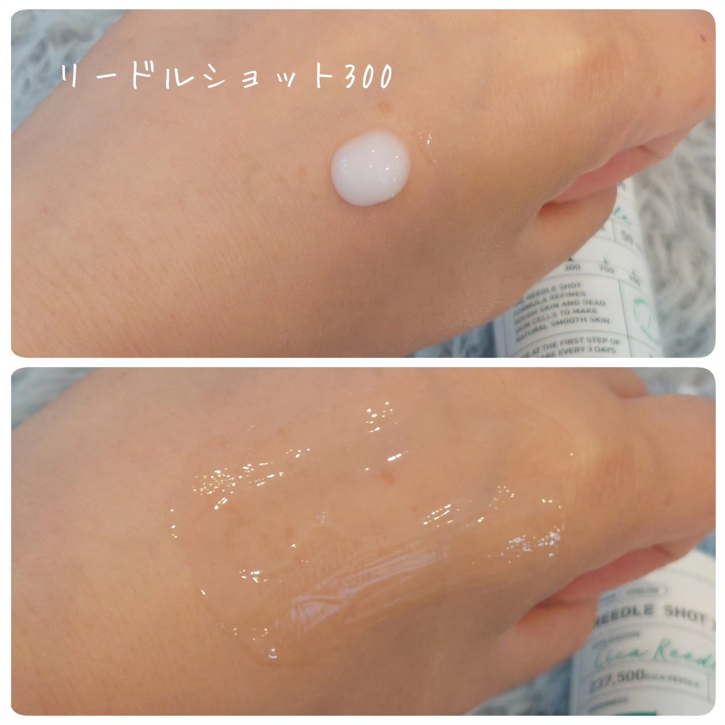 リードルショット300/VT/美容液を使ったクチコミ（2枚目）
