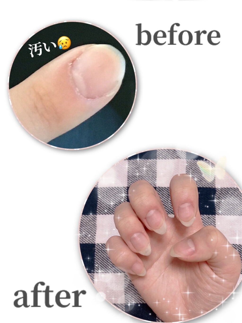 ネイルケアオイル/無印良品/ネイルオイル・トリートメントを使ったクチコミ(1枚目)