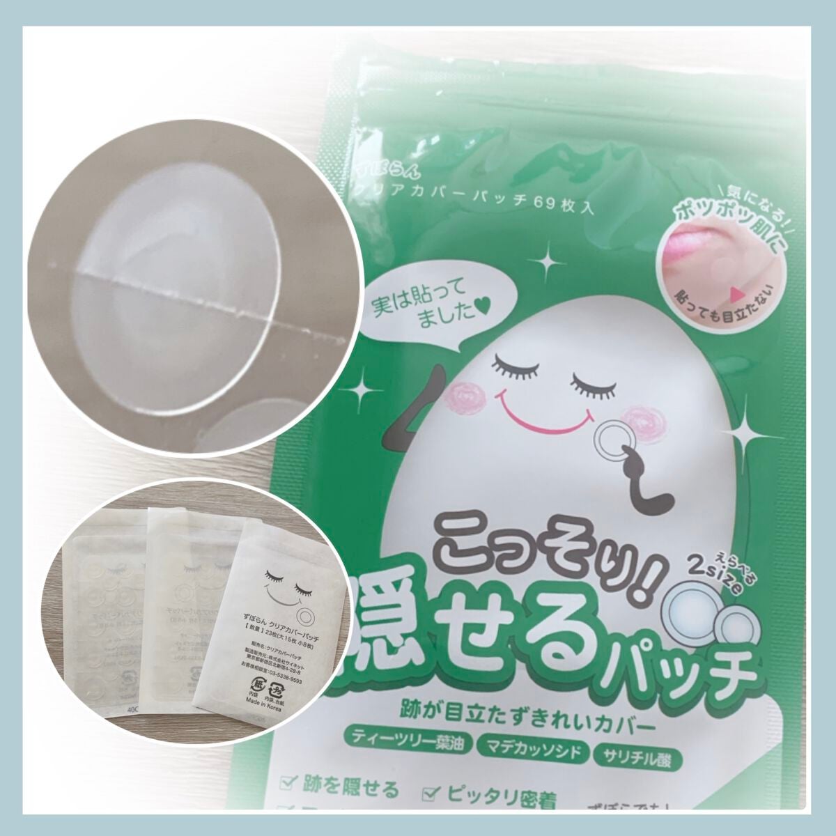 クリアカバーパッチ/ずぼらん/にきびパッチを使ったクチコミ(1枚目)