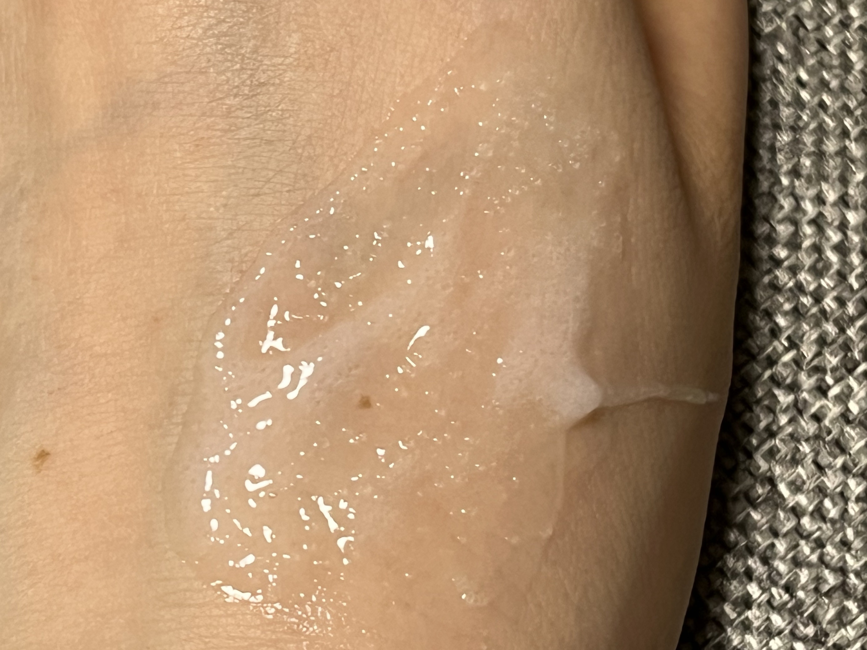  ヘッドスパスカルプスケーラー/CP-1/頭皮トリートメントを使ったクチコミ（2枚目）