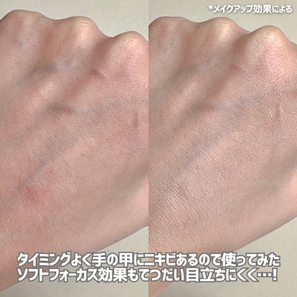 イプノス シーバムクリア リペアクリーム/ACSEINE/フェイスクリームを使ったクチコミ(3枚目)