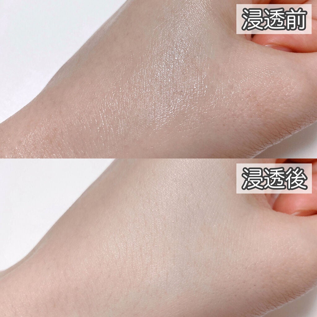 BHA ピーリングアンプル/beplain/美容液を使ったクチコミ(5枚目)