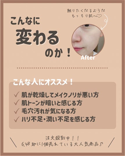 らな ♡ 韓国スキンケア / 韓国コスメ on LIPS 「炭酸泡がクセになる...♡もっちり美白肌になりたい人集合✋👭..」(7枚目)