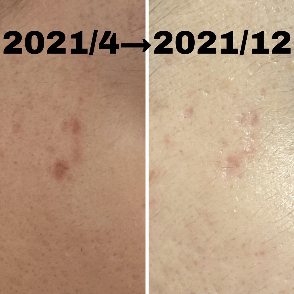 明色美顔水 薬用化粧水/美顔/化粧水を使ったクチコミ（2枚目）