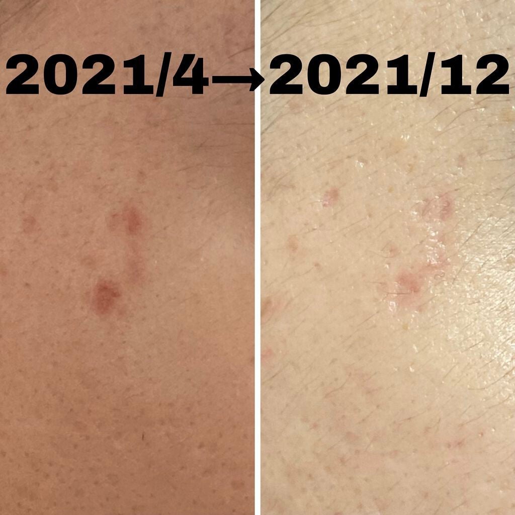 明色美顔水 薬用化粧水/美顔/化粧水を使ったクチコミ(2枚目)