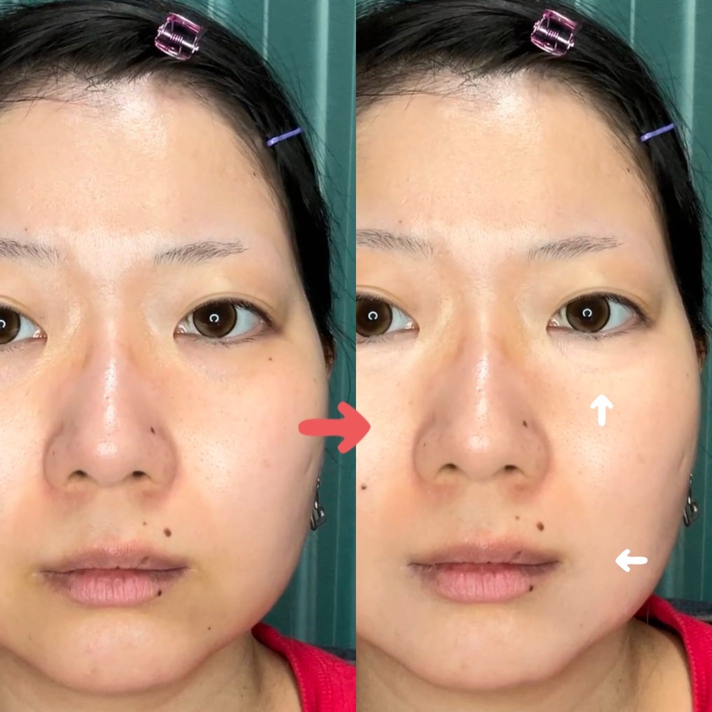 フルカバレッジコンシーラー/TFIT/クリームコンシーラーを使ったクチコミ(5枚目)