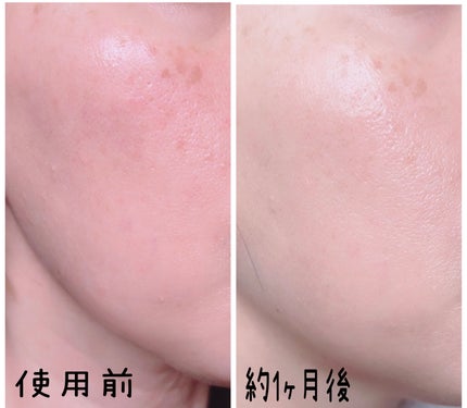 マデカバイタルカプセルセラム/センテリアン24/美容液を使ったクチコミ(7枚目)