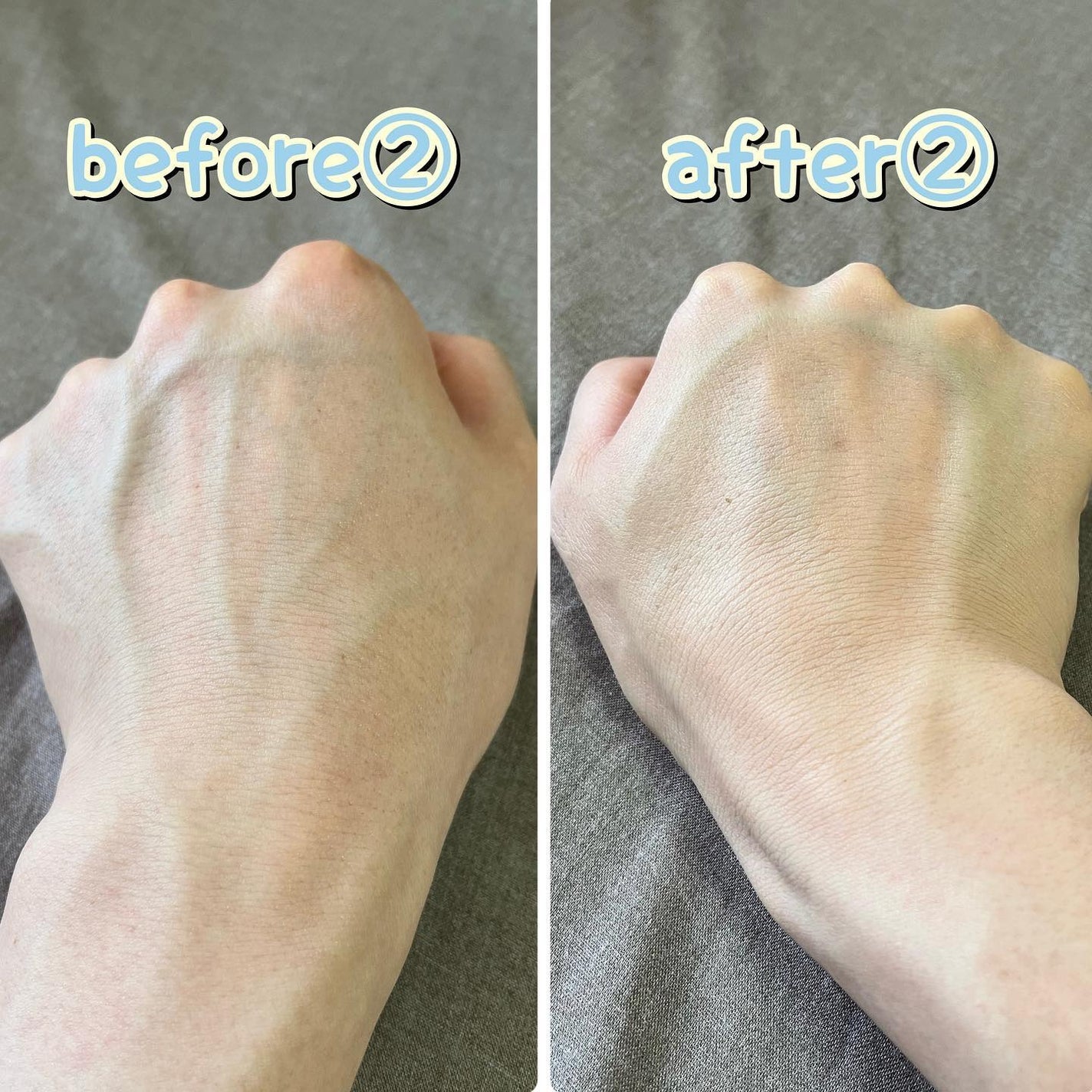 ピンクティーツリーカバーアップグロウクッション/APLIN/クッションファンデーションを使ったクチコミ(5枚目)