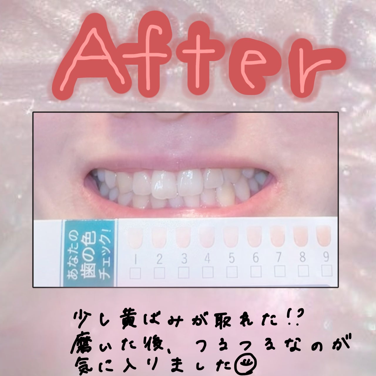 アパガードセレナ/アパガード/歯磨き粉を使ったクチコミ(4枚目)