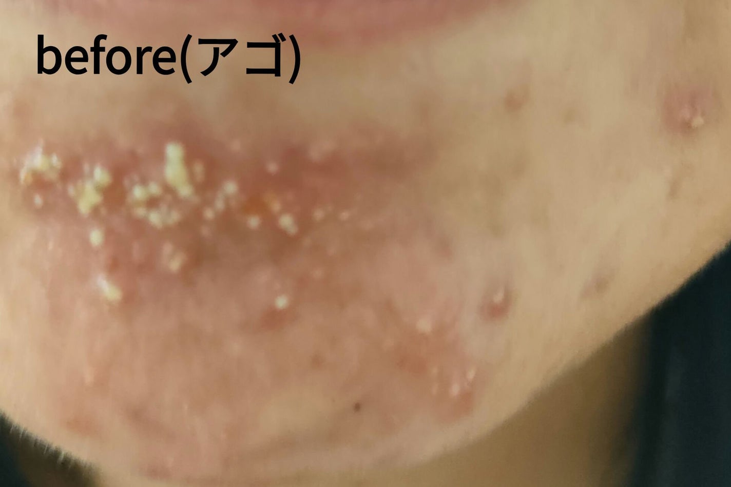 無添加米ぬか洗顔フォーム/ロゼット/洗顔フォームを使ったクチコミ(2枚目)