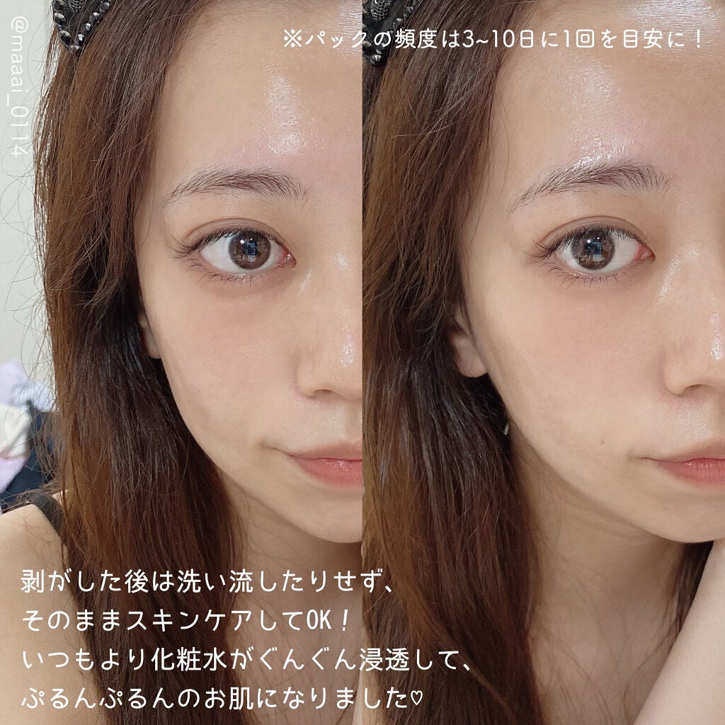 炭酸パック プルリ/ウツクシア/洗い流すパック・マスクを使ったクチコミ(3枚目)