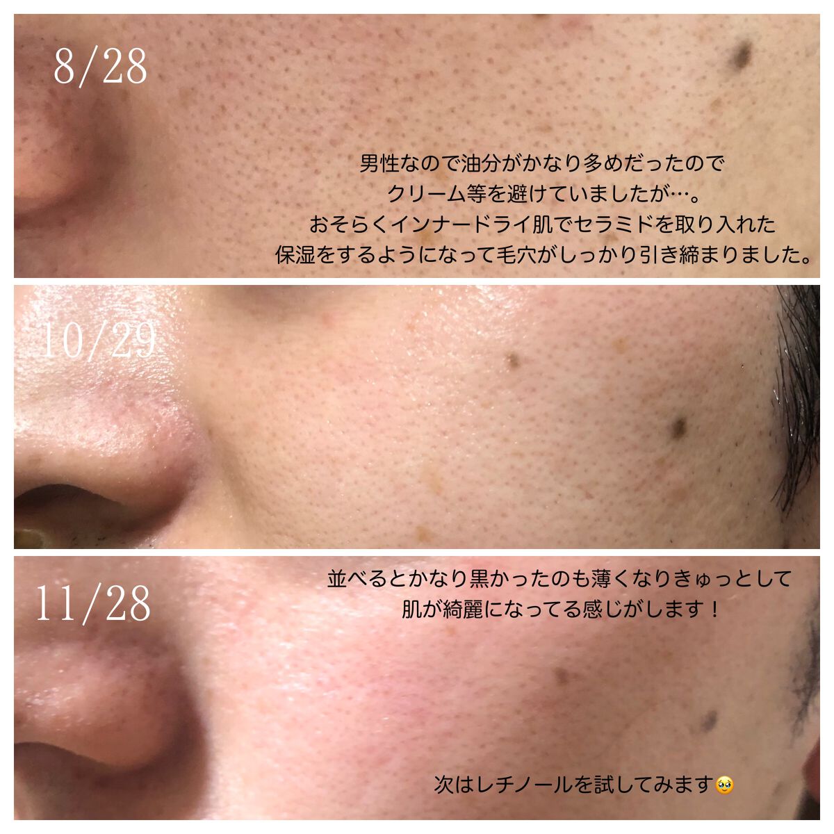 リポソーム アドバンスト リペアセラム/DECORTÉ/美容液を使ったクチコミ(5枚目)