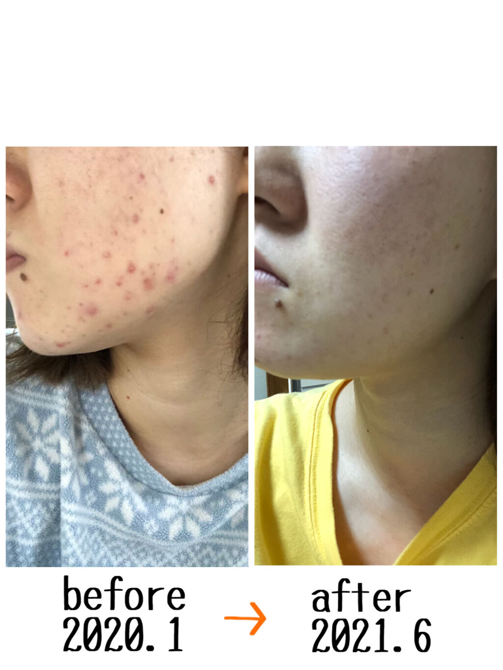 アルビオン 薬用スキンコンディショナー エッセンシャル/ALBION/化粧水を使ったクチコミ（1枚目）