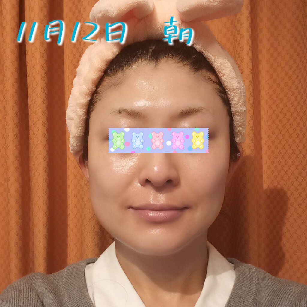 レチノールA 1% アドバンスドリバイタリゼーションクリーム/Life-flo/フェイスクリームを使ったクチコミ（1枚目）