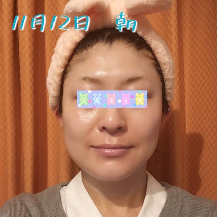 CICA クリーム/VT/フェイスクリームを使ったクチコミ(1枚目)