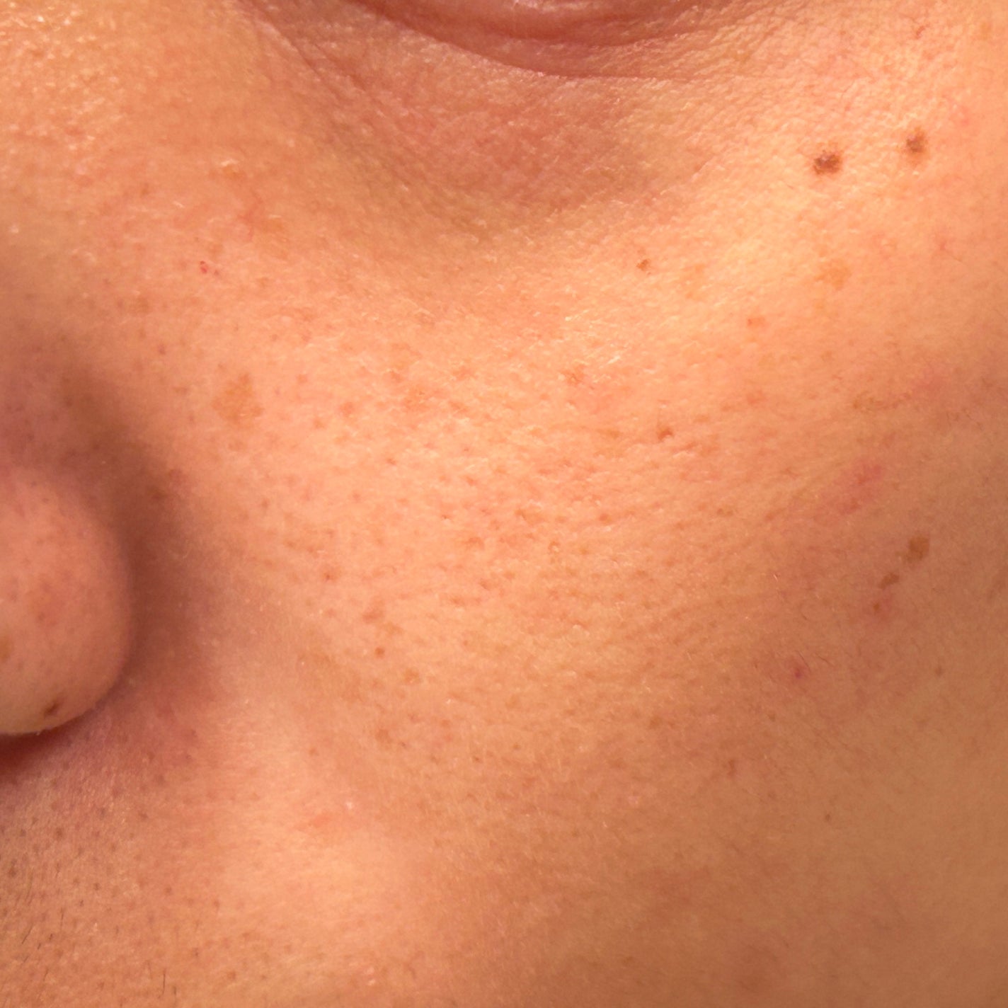 すっぴんパウダー/クラブ/プレストパウダーを使ったクチコミ(5枚目)