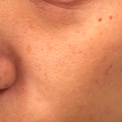 すっぴんパウダー/クラブ/プレストパウダーを使ったクチコミ(5枚目)