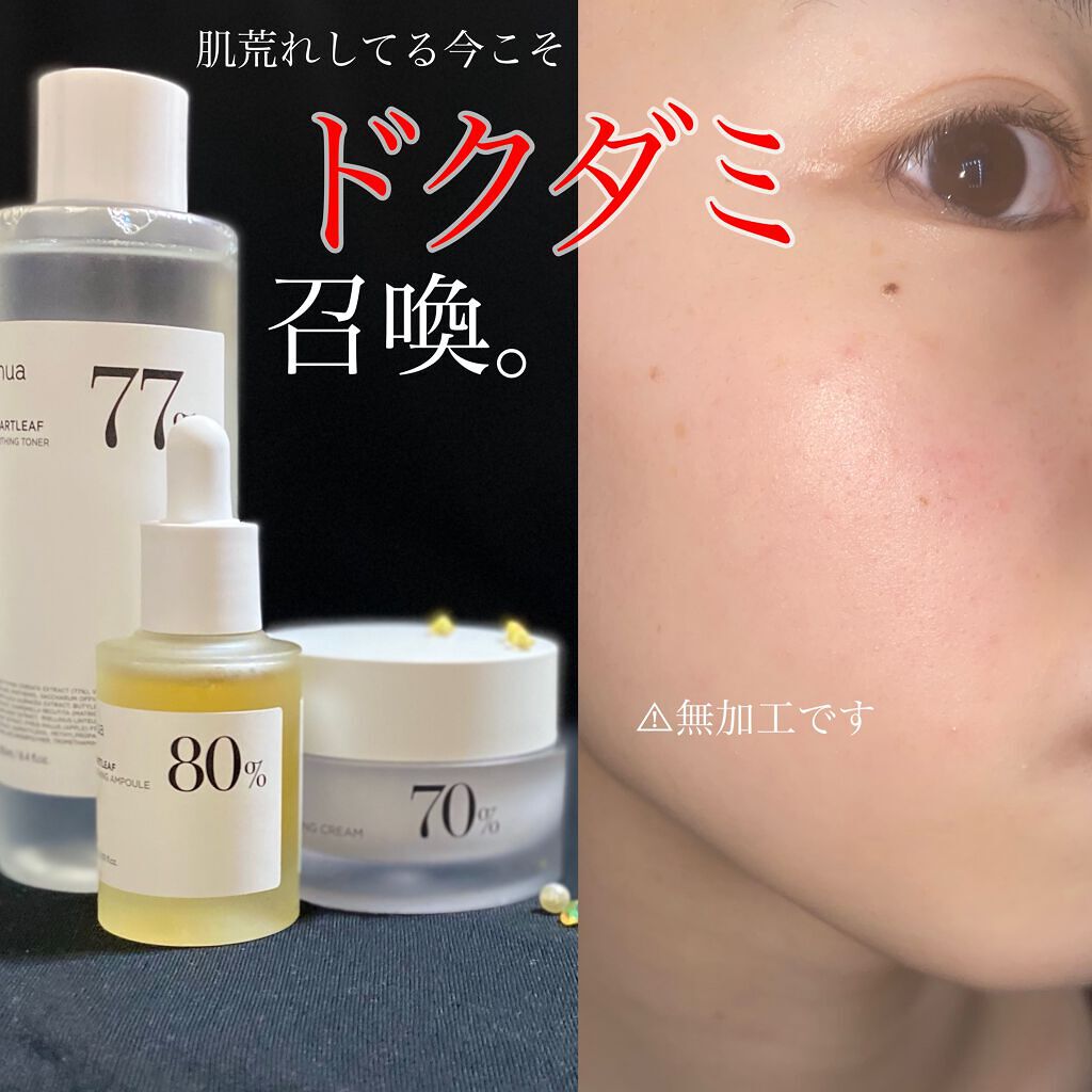 ドクダミ 77 スージングトナー/Anua/化粧水を使ったクチコミ（1枚目）