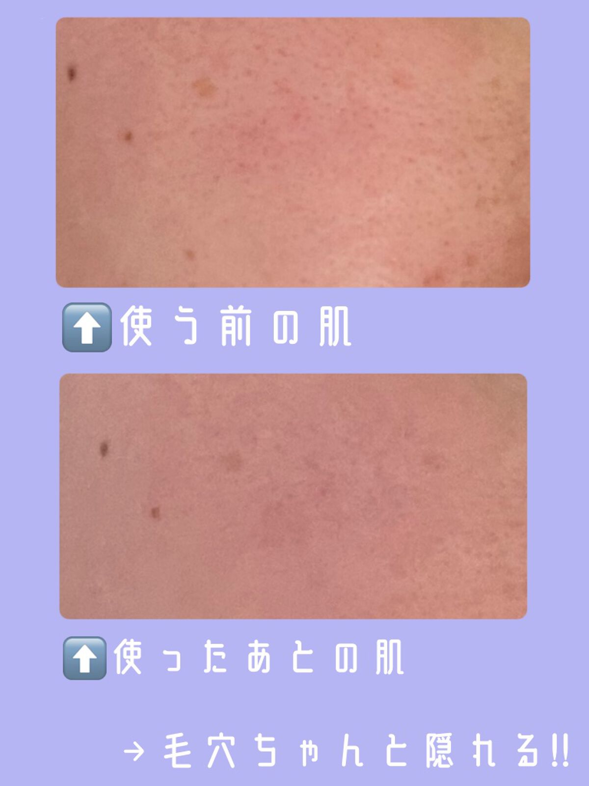 毛穴崩れ防止下地 SP(シアーパープル)/毛穴パテ職人/化粧下地を使ったクチコミ（3枚目）