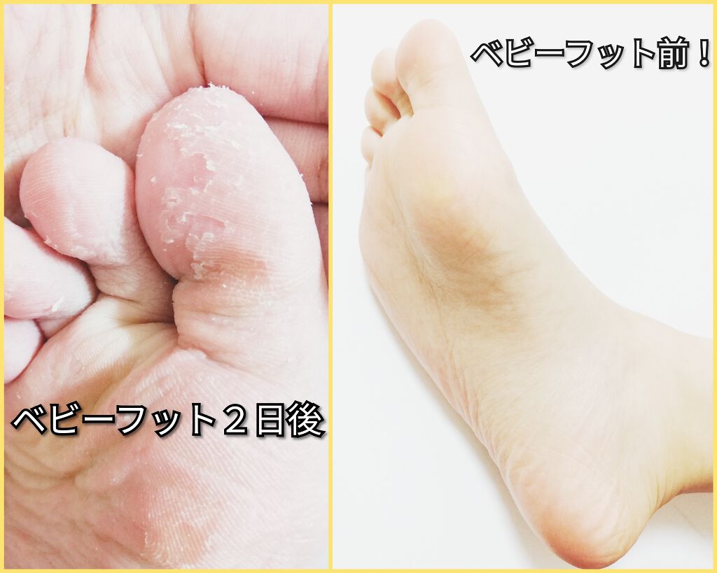 DAISO 人工軽石/DAISO/バスグッズを使ったクチコミ（2枚目）