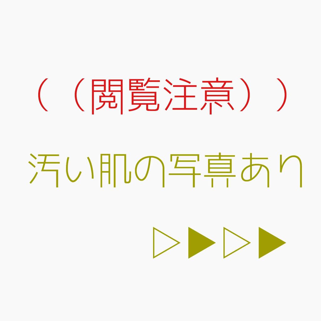 バイオイル/バイオイル/フェイスオイルを使ったクチコミ(2枚目)