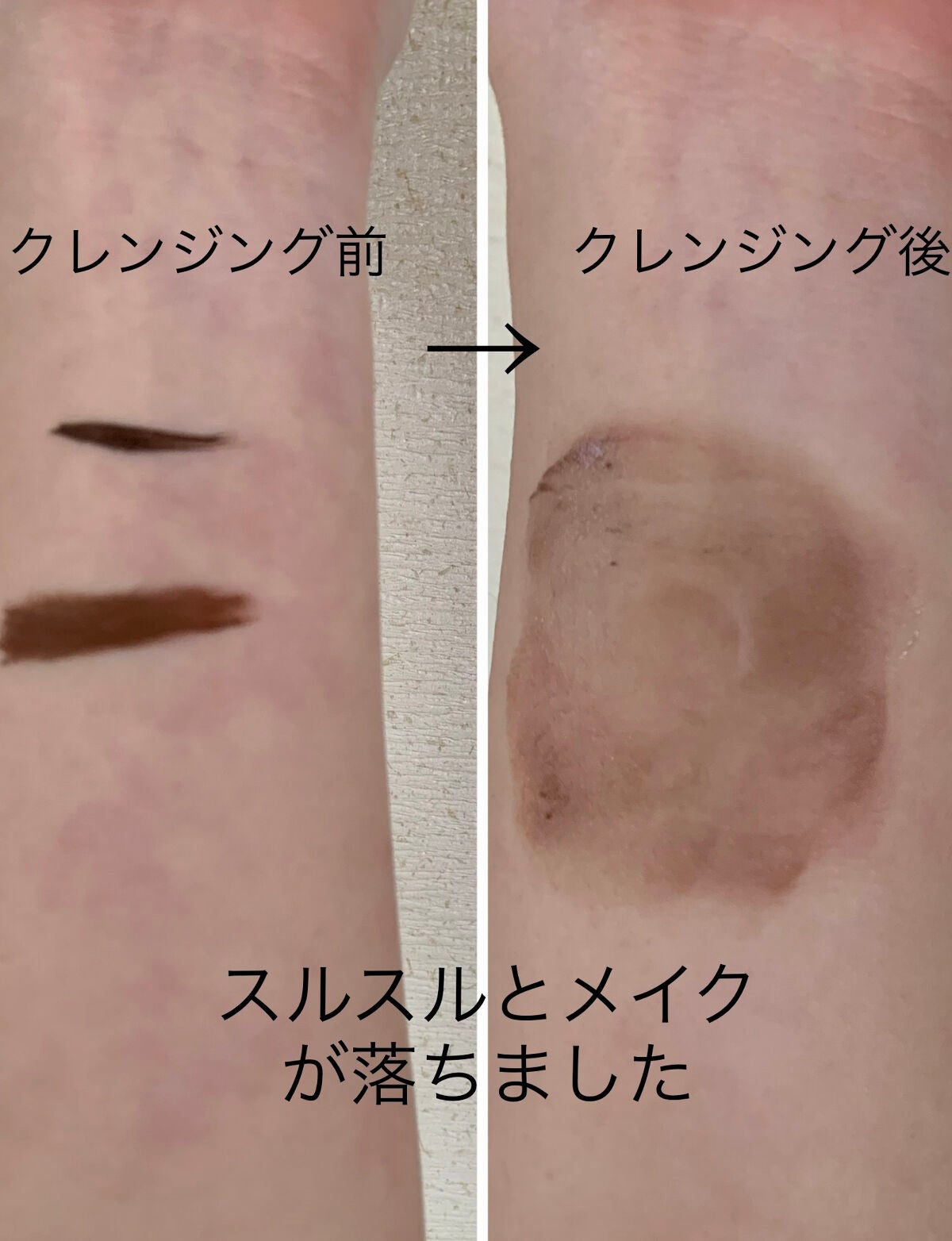 CHOIã¯ã¬ã³ãžã³ã°ãªã€ã« è¬çšãããã±ã¢/èçŸç²Ÿ/ãªã€ã«ã¯ã¬ã³ãžã³ã°ã䜿ã£ãã¯ãã³ãïŒ3æç®ïŒ