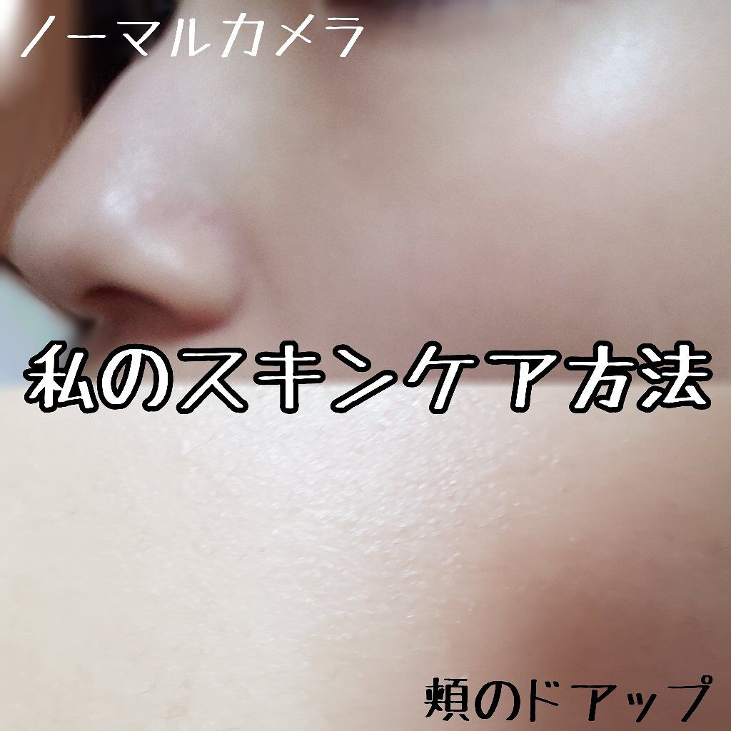 ベビーオイル 無香料/ジョンソンベビー/ボディオイルを使ったクチコミ(1枚目)
